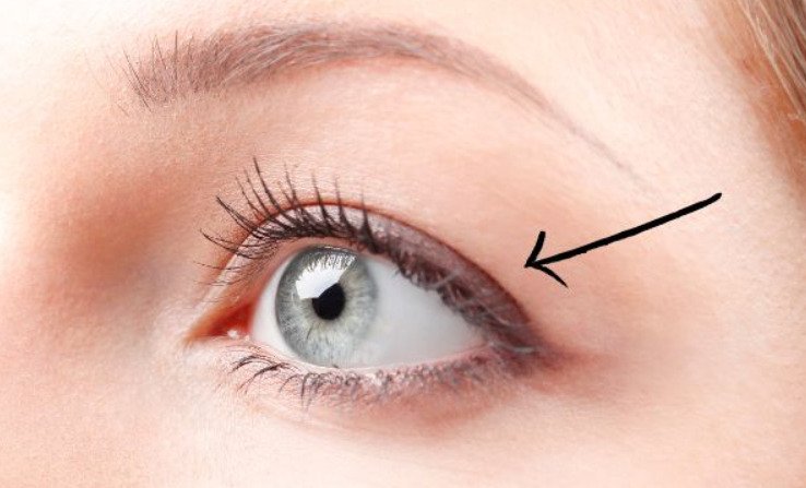 hooded eyes feature deep creases and a little extra skin near the brow area