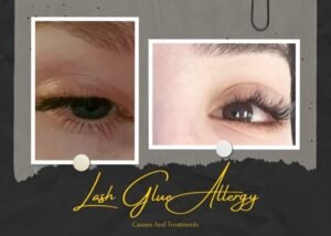 Lash Glue Allergy