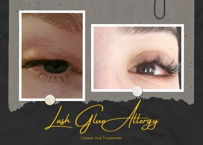 Lash Glue Allergy Causes And Treatments