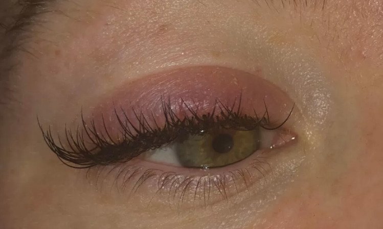 Some people naturally have allergies when getting eyelash extensions