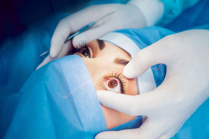Are eyelash extensions safe for Women who have undergone recent eye surgeries