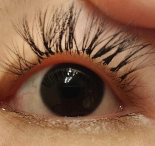 Eyelashes get clumpy