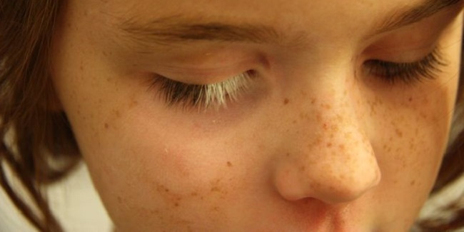 Eyelashes turn white