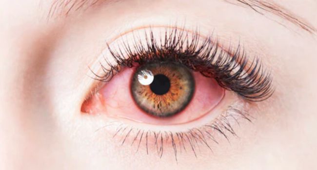 Signs of Bad Eyelash Extensions