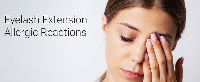 An allergic reaction is risk of eyelash extensions