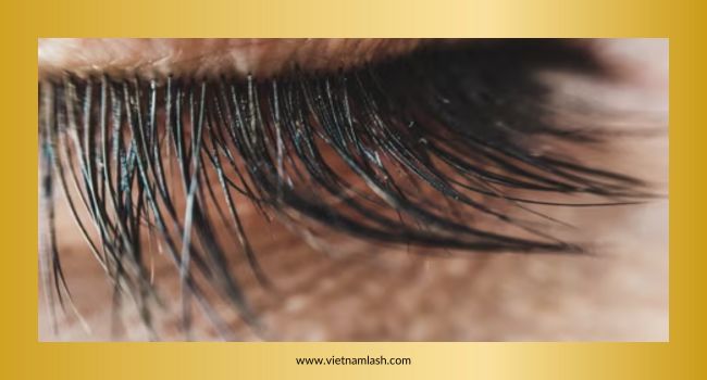 Eyelashes serve as a natural shield for the eyes
