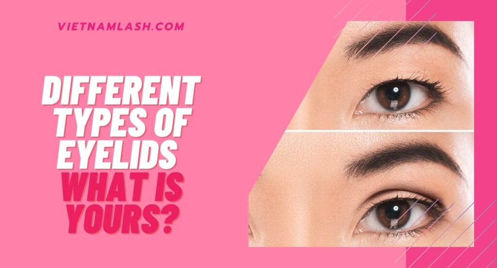 types of eyelids