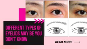 types of eyelids