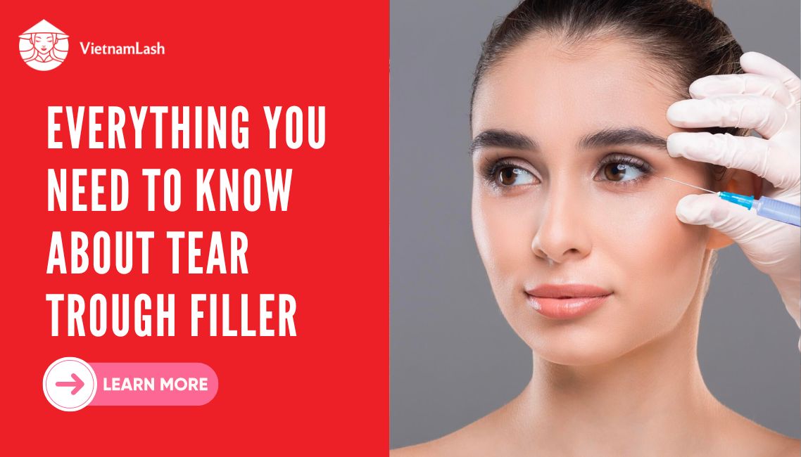 Everything You Need to Know about Tear Trough Filler