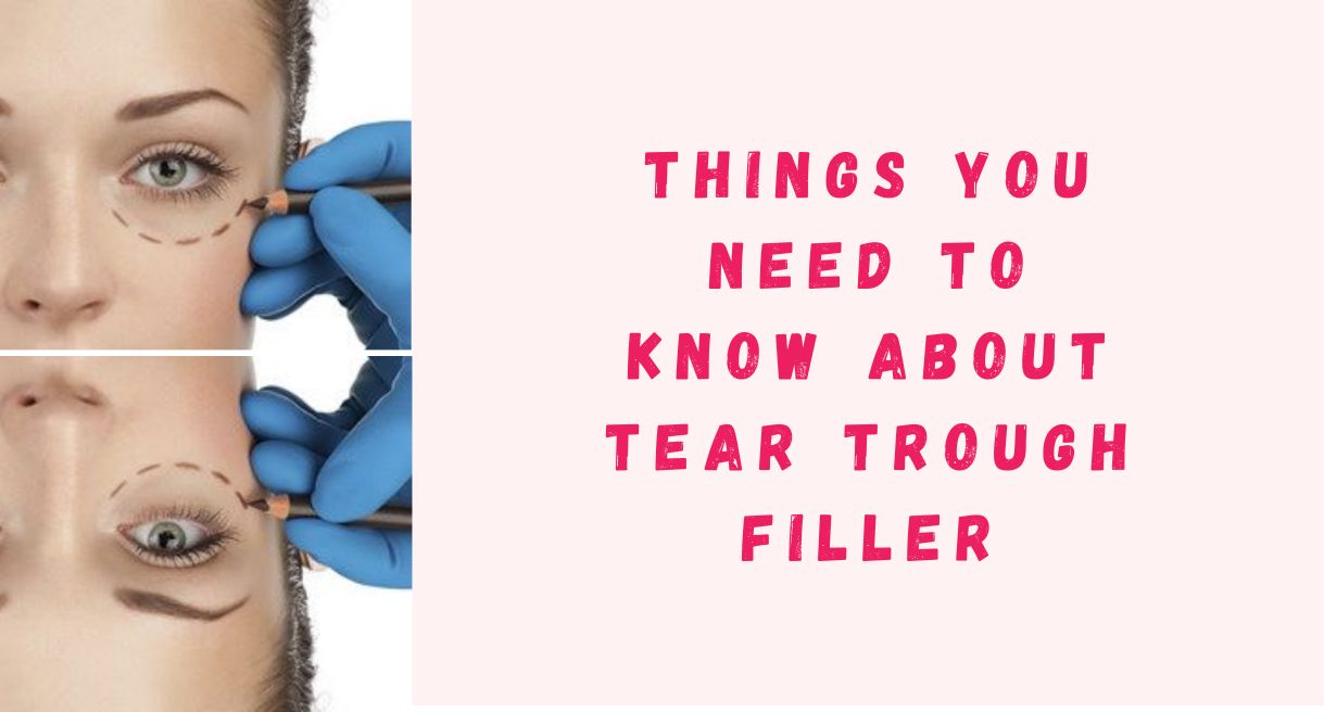 Everything You Need To Know About Tear Trough Filler