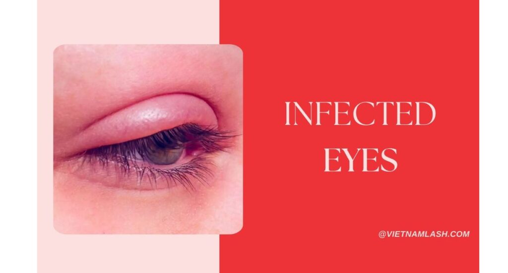 side effects of eyelash extensions