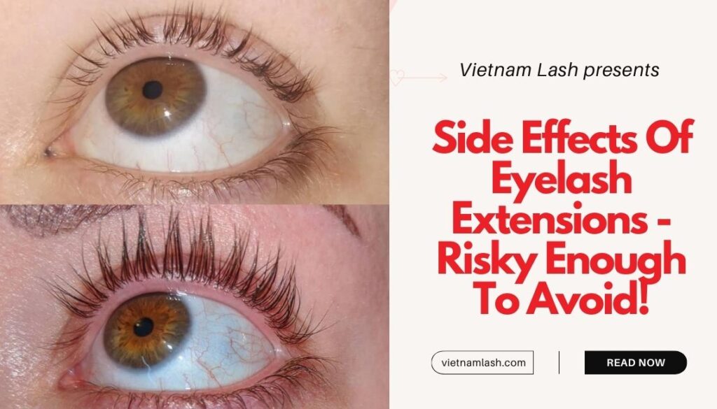 Side Effects Of Eyelash Extensions