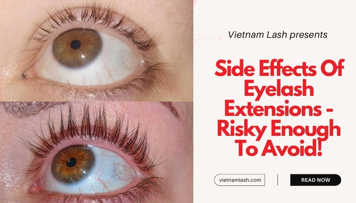 Side Effects Of Eyelash Extensions - Risky Enough To Avoid!