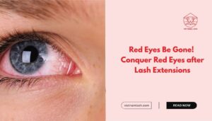 Red eyes