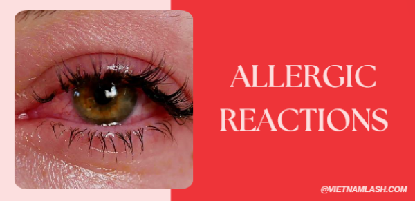 allergic