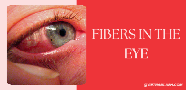 fibers