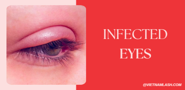 infected